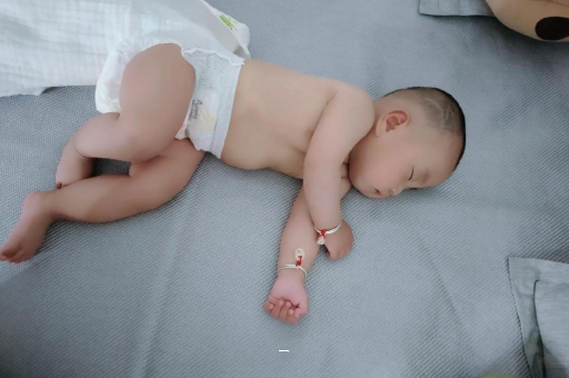 鄢陵宝宝脸上有白色斑块